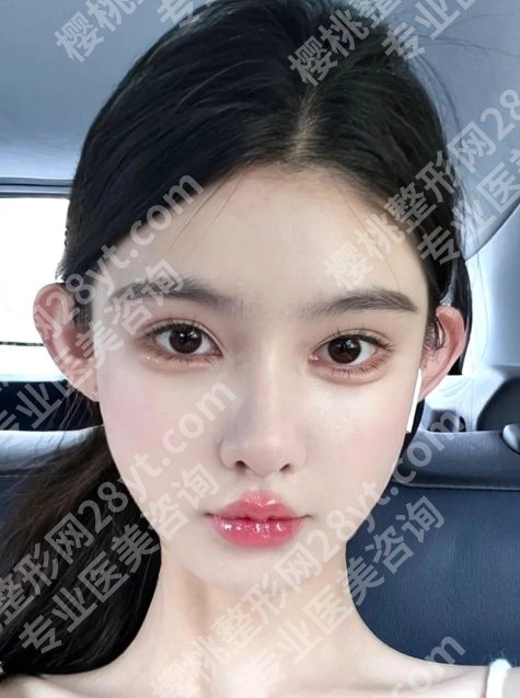 北京丰联丽格师丽丽价格贵吗?医生详细介绍、真人案例曝光
