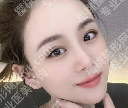 弋矶山医院双眼皮修复怎么样?了解医院信息详情
