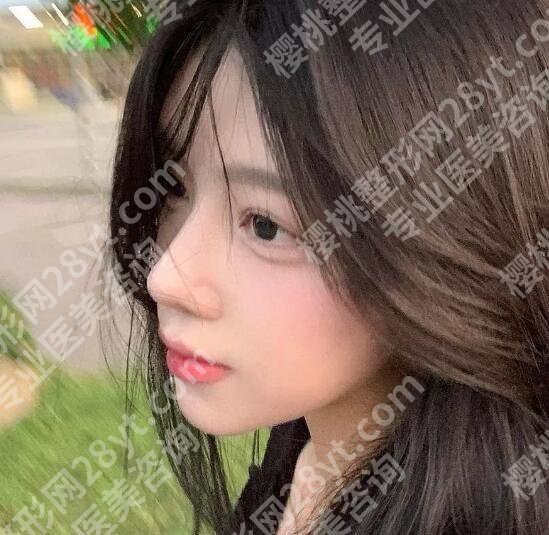 上海九院戴婷婷费用贵不贵?2025相关项目收费表一览!
