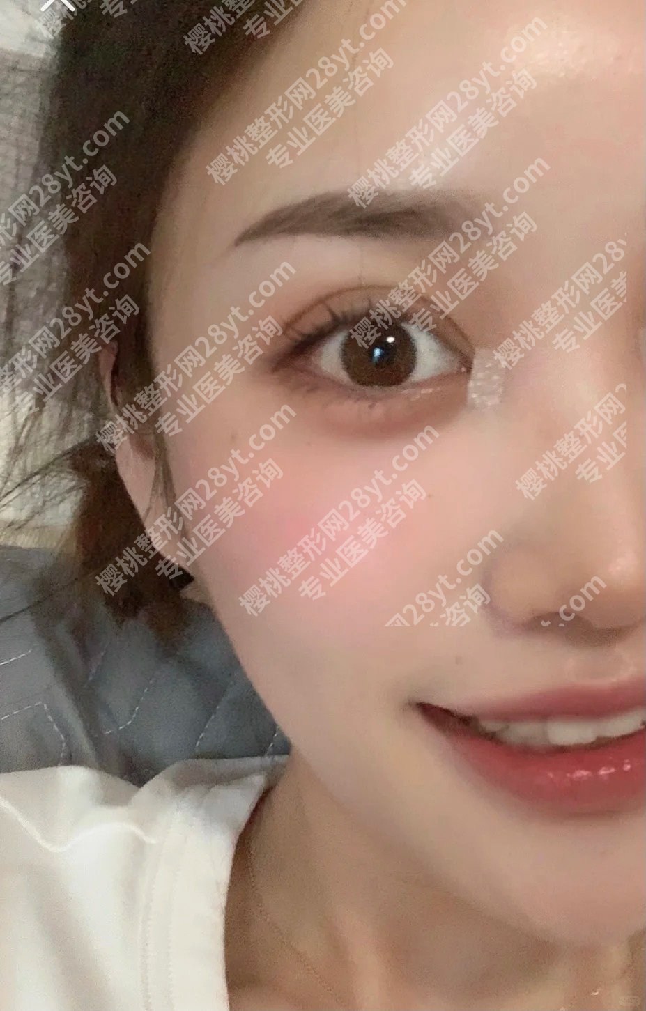上海伊莱美朱迪割双眼皮怎么样?医生简介、面诊攻略、心动案例