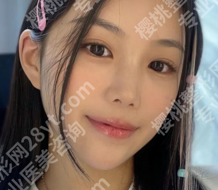 上海九院戴婷婷怎么样?一键了解人气医生信息