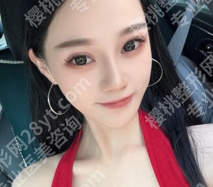 上海国际医院整形科怎么样?医院口碑评价+详细地址介绍!