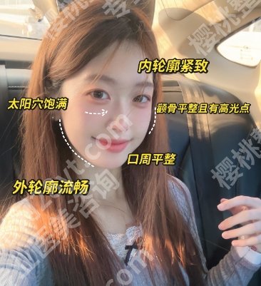 济南颧骨颧弓整形医院推荐!下面这几家医院在当地备受欢迎哦!