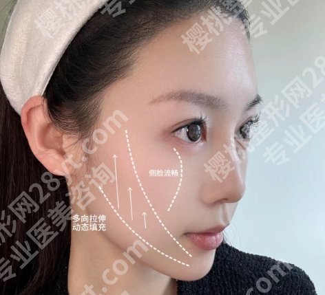 广医一院脂肪填充多少钱?项目收费明细一览!就诊必看