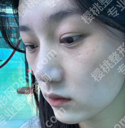 湘雅二医院烧伤整形美容外科专家哪位好?王先成、方柏荣等技术不凡!
