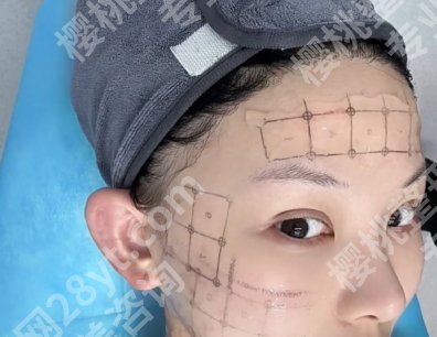 福州热玛吉官网认证的机构有哪些?当地实力派医院推荐给大家