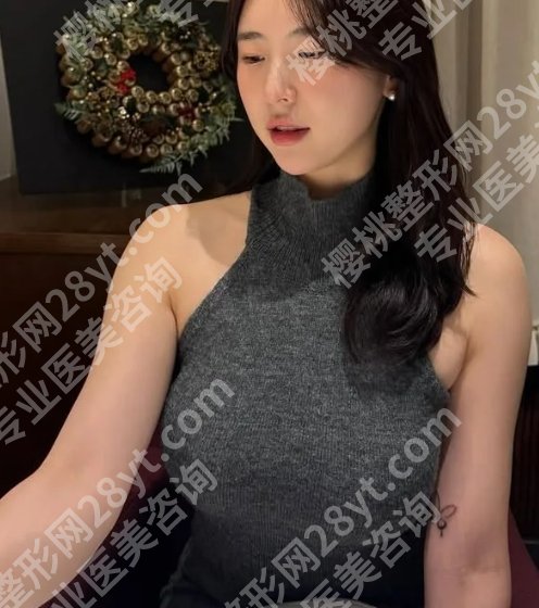 吴小蔚医生隆胸价格多少?隆胸费用1W元起,案例过程查看