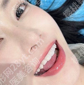 上海诺贝特口腔门诊部怎么样?院内特色项目及真实用户口碑分享!