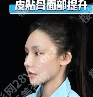 南京筋膜提升多少钱?2025价格表一览+医院top更新!