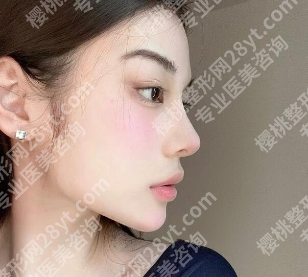 高俊明医生挂号难不难?下颌角磨骨大佬实力揭晓!