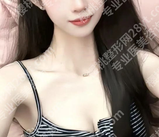 广西医科大学第一附属医院隆胸成功案例分享,优选案例过程详情