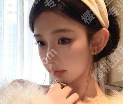 孙好杰做鼻子好吗?了解人气医生资料,分享面诊流程