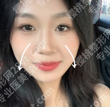 北京高明英医生资质高不高?做除皱技术靠谱吗?案例图反馈!