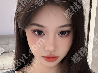 杭州面吸哪里做的好?人气医院一一了解