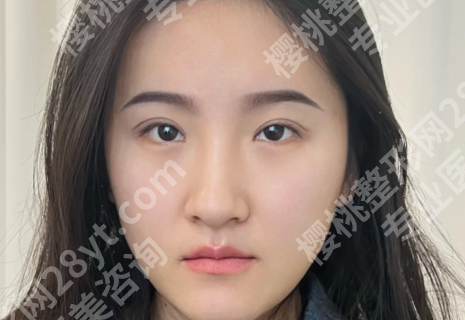 孙好杰做双眼皮怎么样?了解人气医生资料_含案例过程