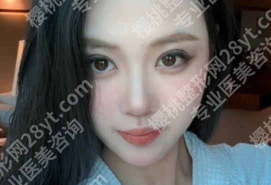 徐威医生技术怎么样?脂肪填充、吸脂、双眼皮都很擅长!