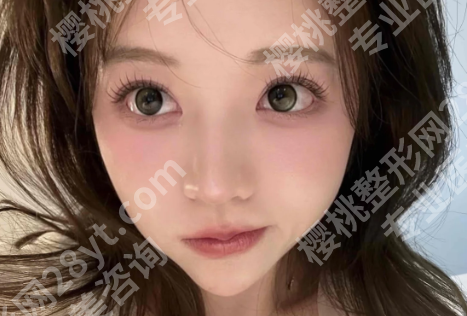 大连杨熙修复怎么样?一起来看看修复案例过程分享