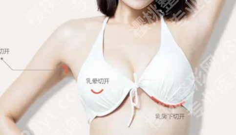 上海第九人民医院隆胸专家简介如何?含医生信息_价格一览表分享