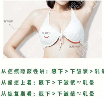北京协和医院隆胸技术如何?含医院信息和预约方式一览查看