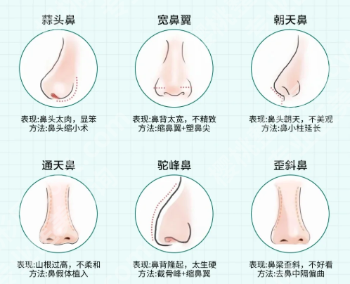 冯思阳口碑怎么样?分享医生资料,附详细案例了解