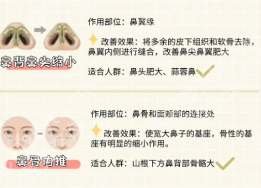 中日友好医院隆鼻好的医生有哪些?公布几位医生信息一览