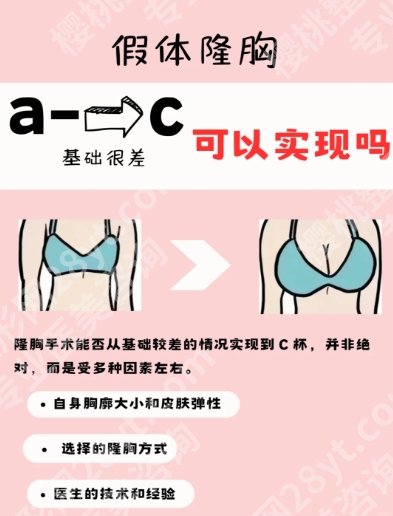 曾昂医生的手术费多少?隆胸价格4W元起