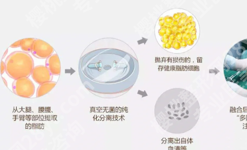 西安医学院第二附属医院隆胸多少钱?了解价格明细,含隆胸医生名单