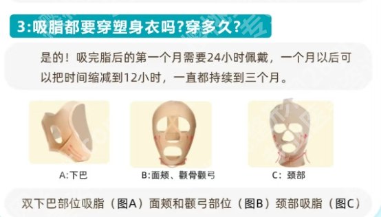 浙江大学医学院附属第一医院整形外科面部吸脂多少钱?医院设备及技术水平!