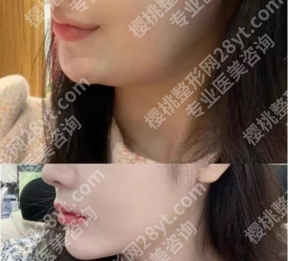 重庆面吸排名前十名有哪些?2025医院排行榜名单更新!