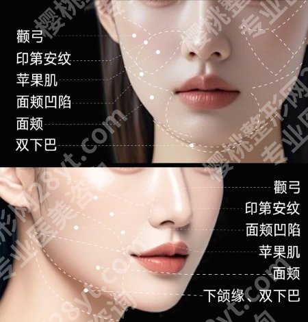 潍坊面部吸脂哪里好?2025医院排行榜名单出炉!