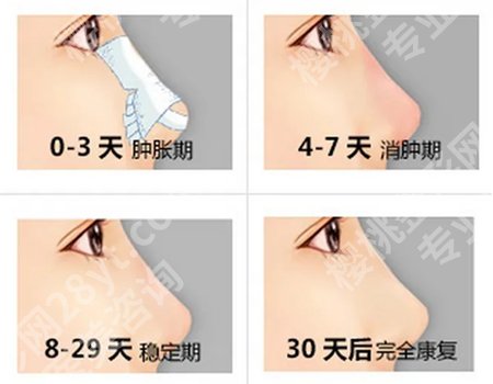 姜平医生和王绥江技术哪个好?后面附上选医生的小妙招