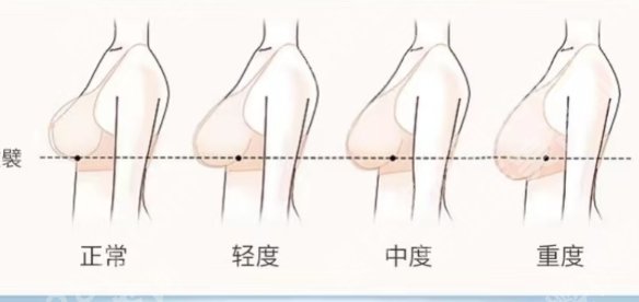 沈正宇做胸部悬吊术怎么样?技术测评|擅长项目介绍!