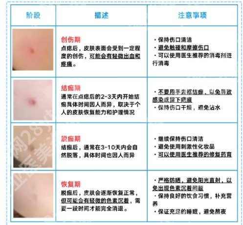 滁州第一人民医院激光祛痣多少钱?主打项目及价目收费表单更新一览!