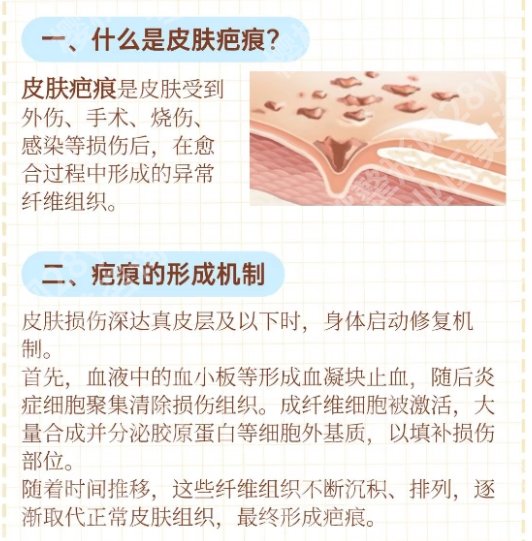 复旦大学附属儿科医院整形外科专家相关介绍!整形项目介绍!收藏再看!