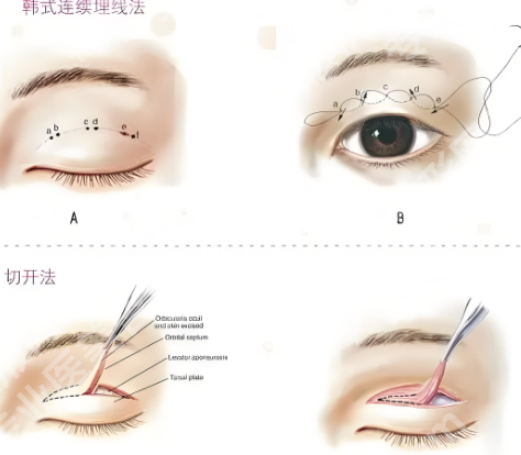 孙玮奇医生案例怎么样?详细流程一一查看,戳进来看