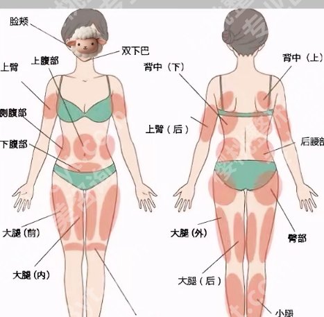 刘珍君吸脂技术靠谱吗?近期案例展示!来看效果图