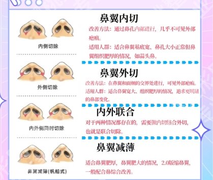 邱文苑做鼻子怎么样？医生基本信息|真人隆鼻案例图展示！