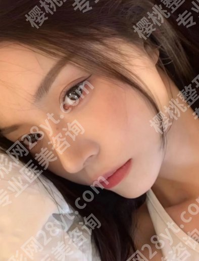 华西李正勇医生怎么样？双眼皮、隆鼻、隆胸样样拿手！