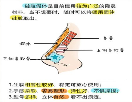 杭州张建文医生鼻子案例怎么样?隆鼻案例详情戳进来看