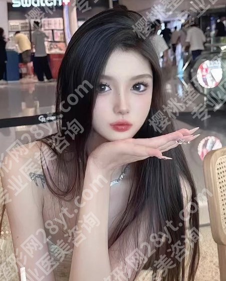 徐海艇医生自体脂肪案例分享!20多年经验、审美好、技术精湛!