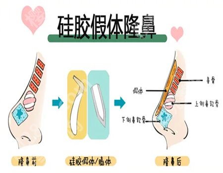 北京刘暾博士擅长什么手术?医生选择小科普盘点
