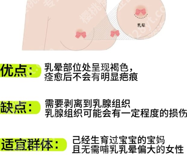 广州南方医院隆胸怎么样？附院内项目相关介绍！真实网友反馈来袭！