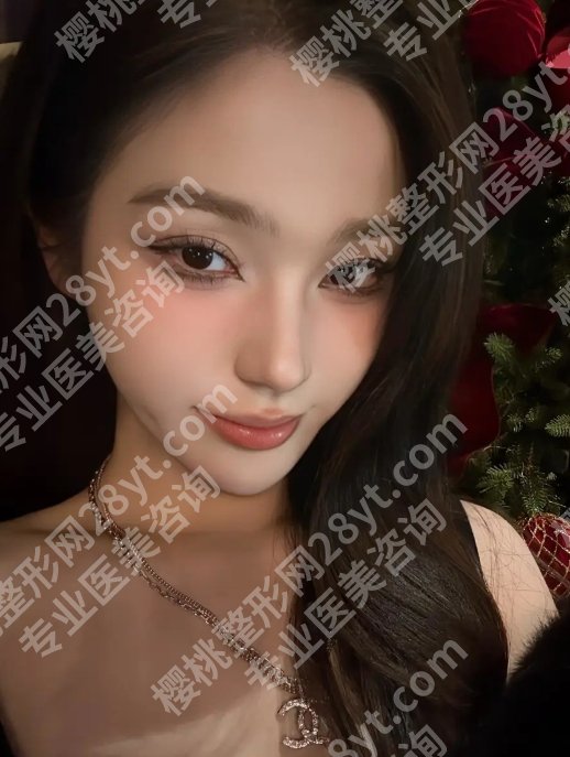 董岩岩医生能做大拉皮手术吗？技术口碑双在线！为人亲和、工作严谨！