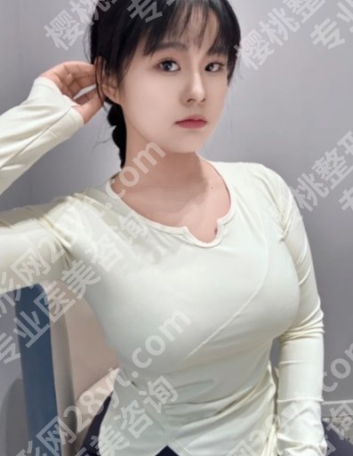 许扬滨丰胸到底怎么样?技术精湛、案例海量!妥妥隆胸大拿