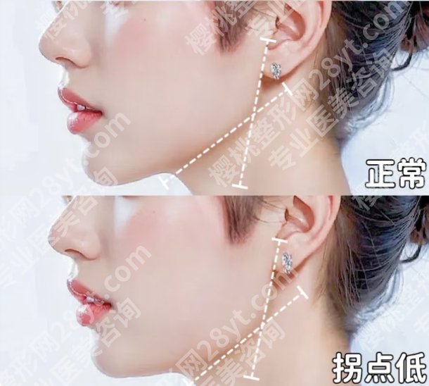 北京联合丽格磨骨怎么样？戳进来看真实的案例鉴赏！