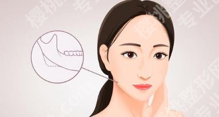 游晓波医生擅长的项目有哪些？附真实的口碑点评！