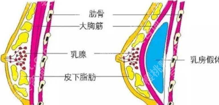 成都美莱熊猛怎样？擅长的领域是什么？戳进来看