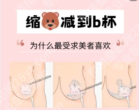 北京八大处胸部缩小术多少钱？医院信息|全新价目表更新！