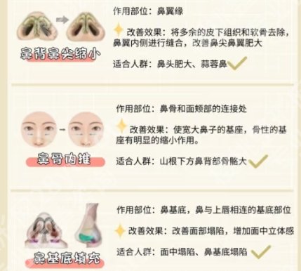 广医一院做鼻子手术费用贵不贵？2025价目表更新！