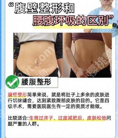 孙逸仙医院抽脂怎么样?戳进来看真人的吸脂案例吧